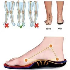 Sapatos Ortopédicos, Sapatos Femininos para Alívio da Dor no Calcanhar XU7J