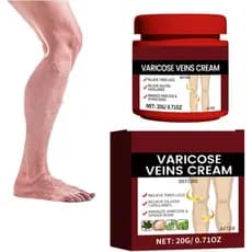 Creme para Cuidado de Pernas com Varizes - Varizes e Vasinhos, Cuidado Natural para as Pernas, Melhora a Circulação Sang