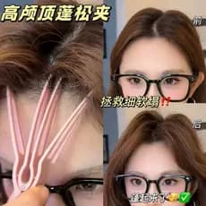 Suavidade de resgate!Nova alta crânio superior ferramenta útil raiz do cabelo fixo clipe fofo sem costura posicionamento