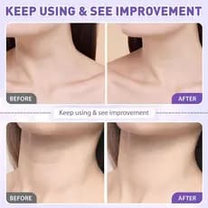 Retinol Firmador para o Pescoço para Tonificar, Reduzir a flacidez da pele, Reduzir linhas finas, Antienvelhecimento, An