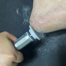 Electric Cordless Foot Callus Remover v2