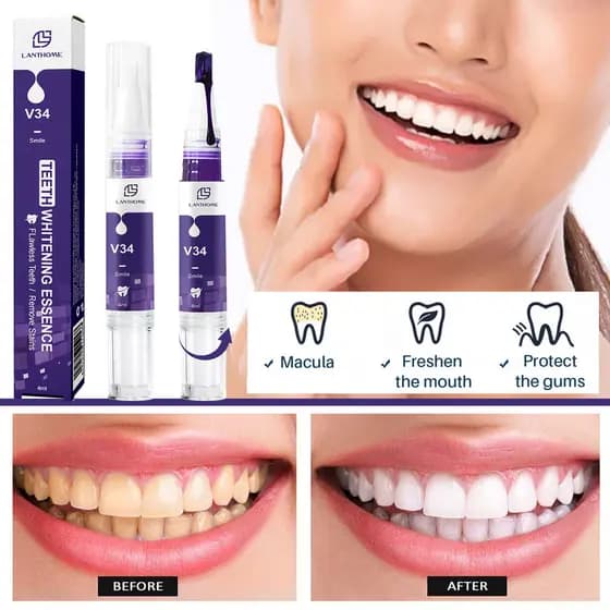 LanthomeV34 Caneta Branqueadora De Dentes Rotativa 4ml