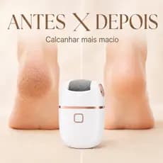 Lixador de Pé Elétrico Portátil para Pedicure - Removedor de Calos e Esfoliador Recarregável USB, Motor Elétrico para Li