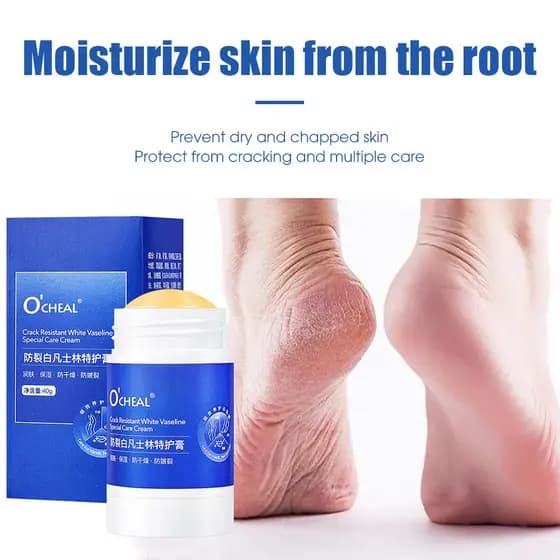 Creme Hidratante para Mãos e Pés com Vaselina Branca Portátil, Anti-Rachaduras, Clareador de Cor, Hidratante, Branqueado