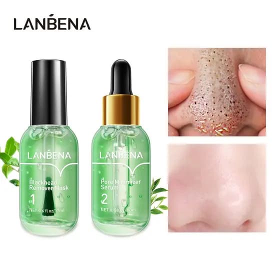 Kit Removedor de Cravos de Chá Verde LANBENA, Reduz Poros, Elimina Marcas de Acne, Remove Cravos, Antiacne 17ml+17ml