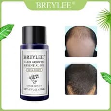 Óleo essencial para crescimento capilar BREYLEE Acelera o crescimento do cabelo, previne a queda de cabelo, cuidado capi