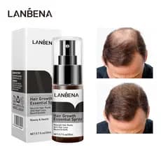 Spray de Essência para Crescimento Capilar LANBENA, Produto Fácil de Transportar, Previne a Calvície, Fortifica e Nutre