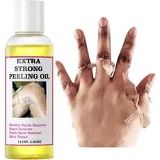 Cascas Químicas Para Rosto E Corpo , Óleo Esfoliante Poderoso Pele Escura , Solução De Casca Química De Fórmula Suave To