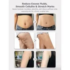Celulite Nos Braços , Ajuda A Microcorrente , Massageador De Máquina Lig & amp ; Barriga , Ferramenta , Corpo Reduz Escu