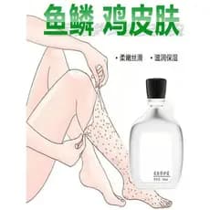 Pele de ganso cutícula esfoliante cutícula escama de peixe creme de pele de cobra esfoliante pele seca braço perna ponto