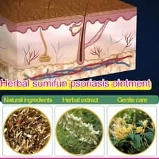 【Para Toda Família】Recommended Sumifun Psoriasis Ointment/Creme Psoríase/Pomada para Irritações
