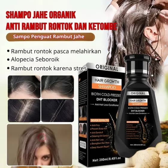 [Fortaleça Seu Cabelo] Shampoo de Gengibre/Crescimento Capilar/Queda de Cabelo/Limpeza Profunda