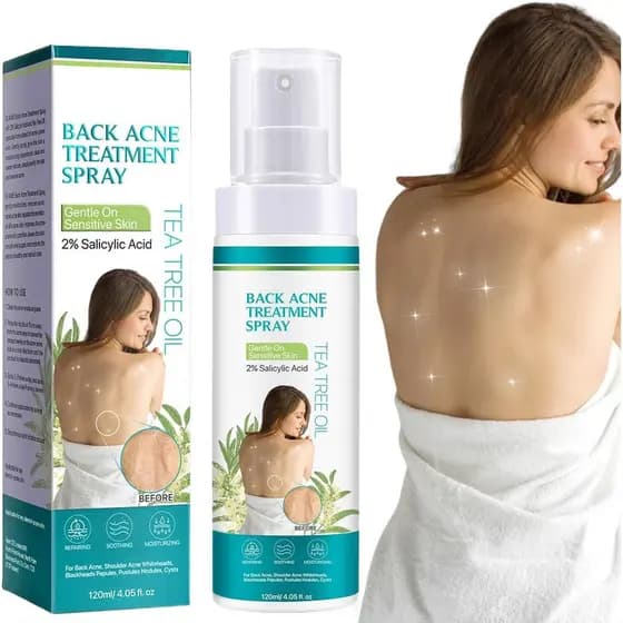 2026 Novo Spray para Tratamento de Acne nas Costas, spray suave e amigável para a pele, para costas e corpo, limpa profu
