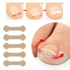 Conjunto De 100 Adesivos Para Os Dedos , Alívio Unhas E Melhora O Cuidado Das Com Suporte Ortopédico , Adesivo
