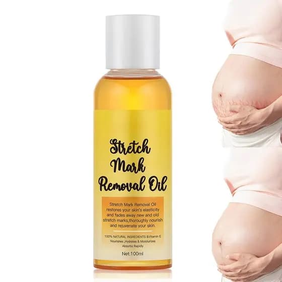 Óleos Corporais para Mulheres - Óleo para Estrias, Óleo de cuidado reafirmante pós-parto, para Estrias, Rugas e Celulite