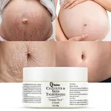 Creme para Remoção de Estrias e Cicatrizes de Gravidez - Reparação de Cicatrizes, Tonificação Abdominal, Remoção Suave d