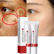 2 Creme Clareador para Sardas, Creme para Tratamento de Cicatrizes de Acne, Creme para Remoção de Pigmentação para o Ros