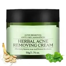 Removedor de Acne para o Rosto, Fórmula Herbal para Acne em Peles Oleosas e Mistas, Reduz Espinhas, Manchas, Cravos, Lim