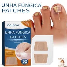 [Entrega 24 horas]50 Peças Adesivos para Cuidados com Unhas - Auxiliar no Tratamento de Onicomicose