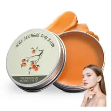 Organics Acne Killer Day Balm 2.0 – Tratamento Natural Botânico para Acne no Rosto, Corpo e Costas |   Reduz espinhas, c