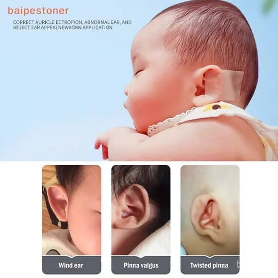 [Corretores De Orelha De Bebê Fita De Silicone Correção Infantil