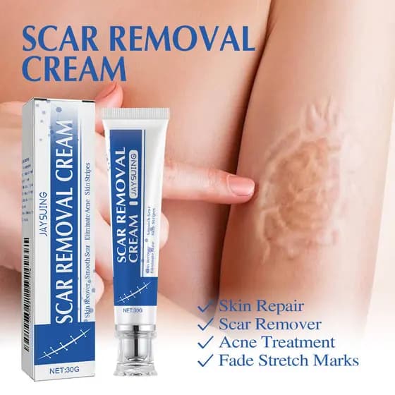 e Sérum Reparador para Remoção de Cicatrizes - Reduz e Clareia Cicatrizes de Queimaduras