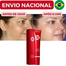 Clareador Premium para Manchas Escuras, Cuidado Avançado para Pigmentação da
