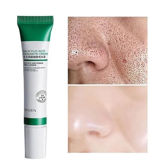 de Ácido Salicílico Verde 20ml para Remoção de Poros/Acne e Clareamento/Iluminação
