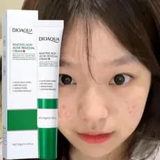 BIOAOUA Ácido Salicílico Creme de Remoção de Acne Hidratante Reduzir Marcas de Acne Reparação Creme de Poros Encolher Cr