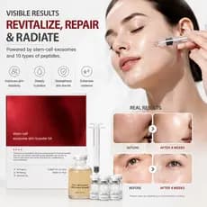 Célula-Tronco Exosome Peptídeo De Colágeno Essência Facial Pó Liofilizado Caixa Anti Envelhecimento Hidratante Brilho En