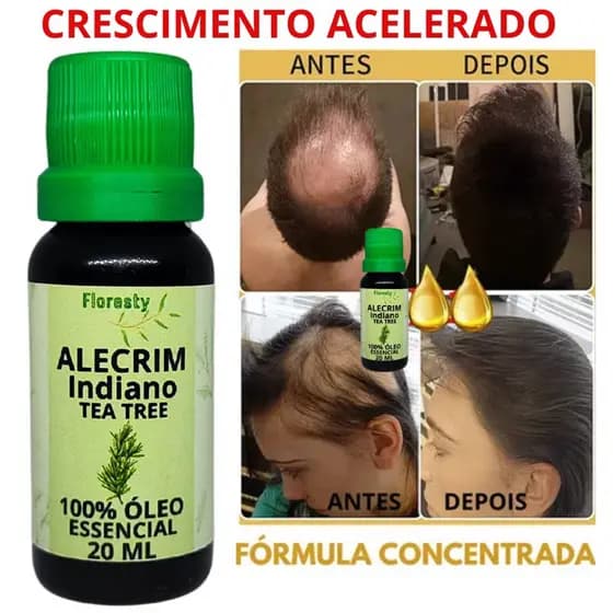 Óleo essencial de Alecrim 100% Puro Natural- Crescimento capilar | cresce 6 cm | preenchimento das falhas | Cabelo Barba