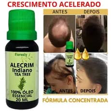 Óleo essencial de Alecrim 100% Puro Natural- Crescimento capilar | cresce 6 cm | preenchimento das falhas | Cabelo Barba