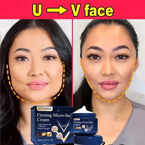 Quente V-Forma Emagrecimento Creme Remoção Queixo Duplo Endurecimento Apertar Linha Mandibular Masseter Rosto Muscular Queima De Gordura