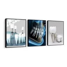Quadro Decorativo Consultório Odontológico 3 Peças 40x60cm  Kit Premium Clínica Dentista  Escritório