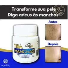 Pomada Clareadora para Melasma NatyFlora – Redução de Manchas e Uniformização da Pele (1 Unidade)