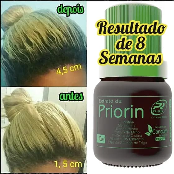 Combate Calvície Loção Capilar Priorin Cresce E Nasce Cabelo