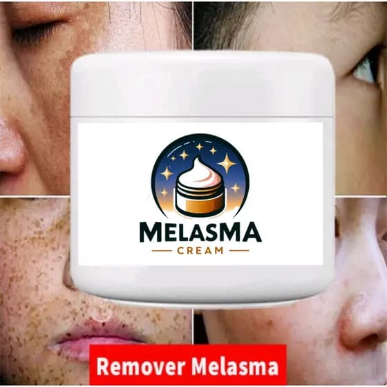 Creme Melasma Remove/Blemishes/Melanina/Clareamento Facial