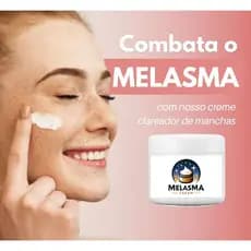 Clareador de Melasma Creme Renova sua Pele