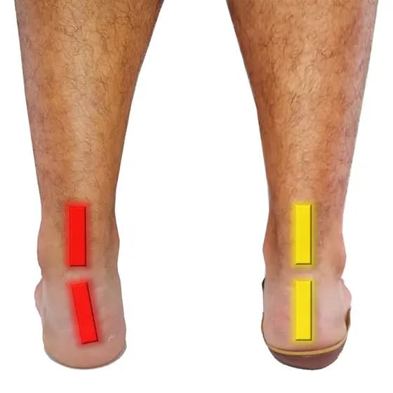 Palmilha Ortopédica Para Pisada Supinada Cappes