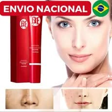 Creme forte original para remover manchas escuras/clareamento pigmentado/cuidados com a pele