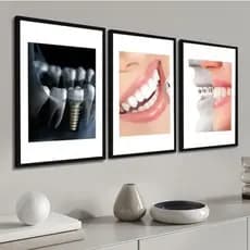 Kit Quadros Decorativo 3 peças 60x40 Mosaico MDF dentista consultório odontologia Decoração Hall