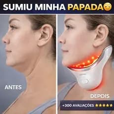 Massageador Facial LED Reduz Papada e Flacidez | Lifting Facial Com Calor