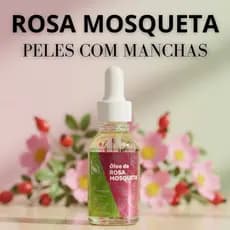 Óleo de Rosa Mosqueta Puro Manchas Estrias Rugas Cicatrizante Hidratante Facial 30ml