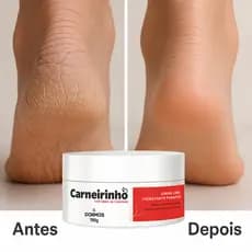 Carneirinho Creme Para Os Pés Diabeticos Com Sebo De Carneiro Rachaduras Ressecados Dokmos