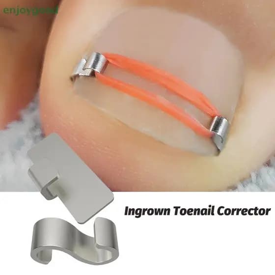 [B & H] Ferramentas Corretoras De Unhas Encravadas Pedicure Recuperar Incorporar Tratamento Ferramenta De Cuidados Com O