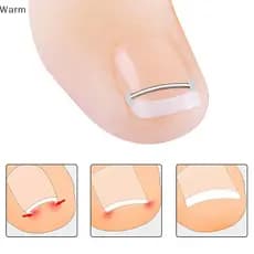 Ferramentas Corretoras De Unhas Encravadas , Quentes , Pedicure , Recuperação , Tratamento Ferramenta De Alisamento Para