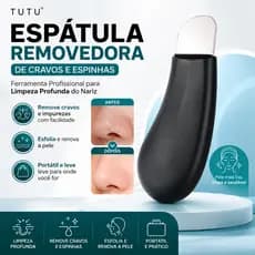 Espátula Removedora Cravos/Espinhas Facial | Ferramenta Prof. TUTU Limpeza Esfoliante do Nariz