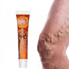 Creme Pomada Para Varizes Tratamento Veias Vasinhos Nas Pernas
