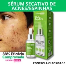 Sérum Facial Efeito Secativo Controle de Acne, Oleosidade, Cravos e Espinhas 30ml | Dermachem