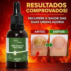 Óleo Melaleuca Essencial Embalagem Contra Gotas 100% Puro 30ML